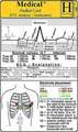 ECG Analysis/Instructions