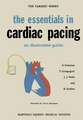 the essentials in cardiac pacing: An Illustrated Guide