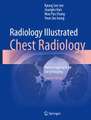 Radiology Illustrated: Chest Radiology: Pattern Approach for Lung Imaging