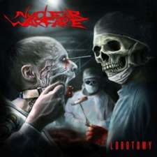 Lobotomy