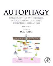 Autophagy: Cancer, Other Pathologies, Inflammation, Immunity, Infection, and Aging: Volume 6- Regulation of Autophagy and Selective Autophagy