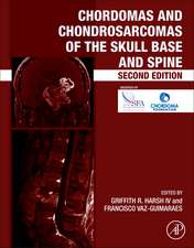 Chordomas and Chondrosarcomas of the Skull Base and Spine