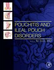 Pouchitis and Ileal Pouch Disorders