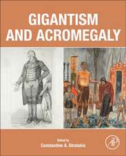 Gigantism and Acromegaly