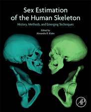 Sex Estimation of the Human Skeleton