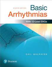 Basic Arrhythmias Plus Mybradylab with Pearson Etext -- Product Package