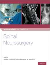 Spinal Neurosurgery