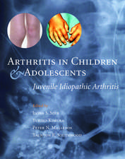 Arthritis in Children and Adolescents: Juvenile Idiopathic Arthritis