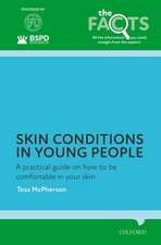 Skin conditions in young people: A practical guide on how to be comfortable in your skin