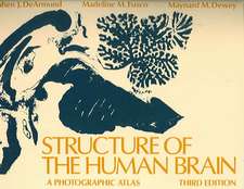 Structure of the Human Brain: A Photographic Atlas