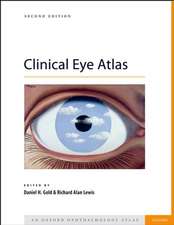 Clinical Eye Atlas