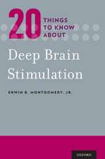 20 Things to Know about Deep Brain Stimulation