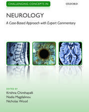 Challenging Concepts in Neurology