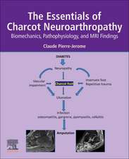 The Essentials of Charcot Neuroarthropathy