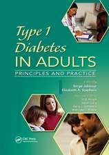 Type 1 Diabetes in Adults: Principles and Practice