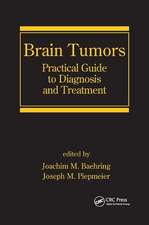 Brain Tumors: Practical Guide to Diagnosis and Treatment