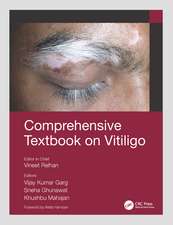 Comprehensive Textbook on Vitiligo