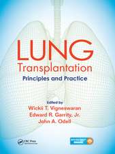 Lung Transplantation: Principles and Practice