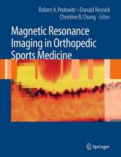 Magnetic Resonance Imaging in Orthopedic Sports Medicine