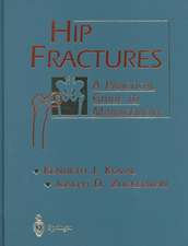 Hip Fractures: A Practical Guide to Management