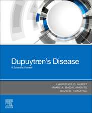 Dupuytren's Disease: A Scientific Review