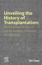 Unveiling the History of Transplantation