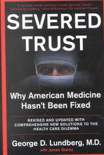 Severed Trust