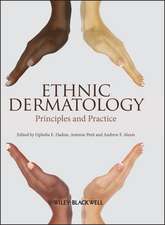 Ethnic Dermatology – Principles and Practice