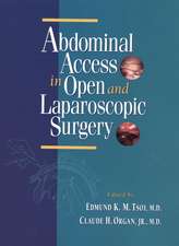 Abdominal Access in Open and Laparoscopic Surgery