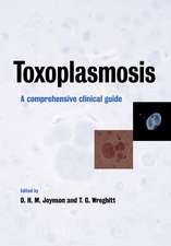 Toxoplasmosis: A Comprehensive Clinical Guide