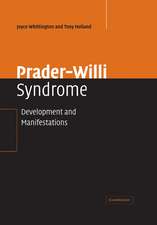 Prader-Willi Syndrome: Development and Manifestations