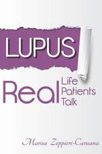 Lupus