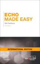 Echo Made Easy