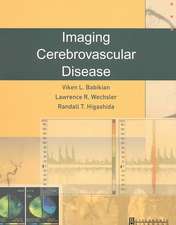 Imaging Cerebrovascular Disease