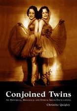 Conjoined Twins: A Historical, Biological And Ethical Issues Encyclopedia