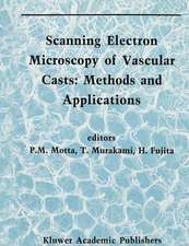 Scanning Electron Microscopy of Vascular Casts