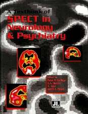 A Textbook of SPECT