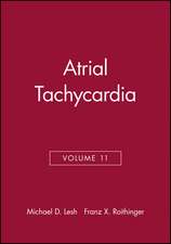 Atrial Tachycardia