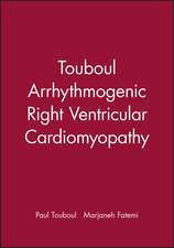 Arrhythmogenic Right Ventricular