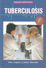 Tuberculosis