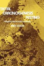 Metal Carcinogenesis Testing: Principles and In Vitro Methods