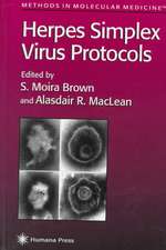 Herpes Simplex Virus Protocols