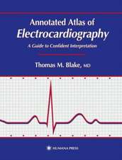 Annotated Atlas of Electrocardiography