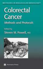 Colorectal Cancer: Methods and Protocols