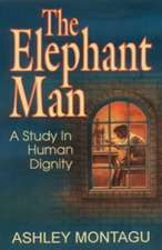 The Elephant Man