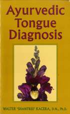 Ayurvedic Tongue Diagnosis