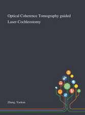 Optical Coherence Tomography Guided Laser-Cochleostomy