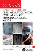 Clark's Essential Guide to Musculoskeletal X-ray Interpretation for Radiographers