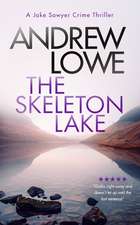 The Skeleton Lake