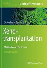 Xenotransplantation: Methods and Protocols